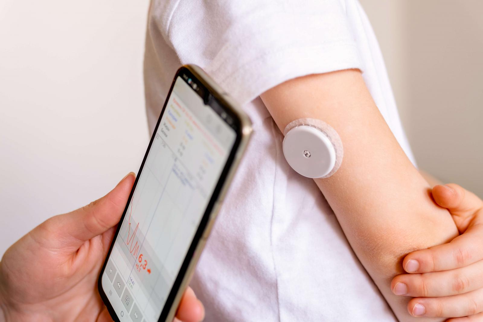 Image of Continuous Glucose Monitor on the back of a person's arm with person holding phone with monitoring app.
